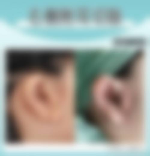 汕头悦美整形医疗美容抖音团购活动及价格表