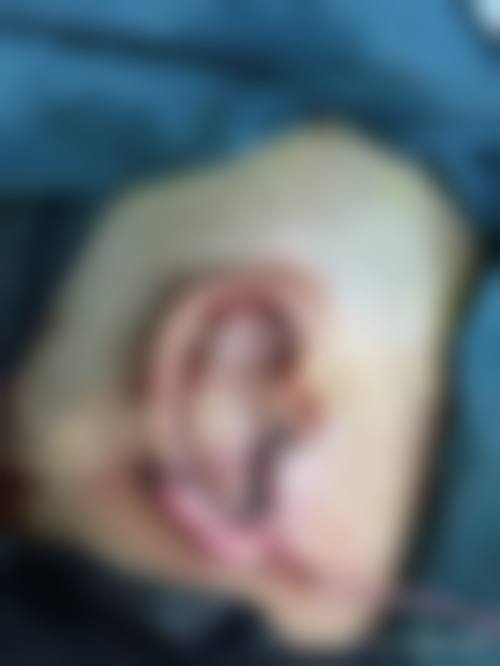 陈孝闯医生简介口碑如何