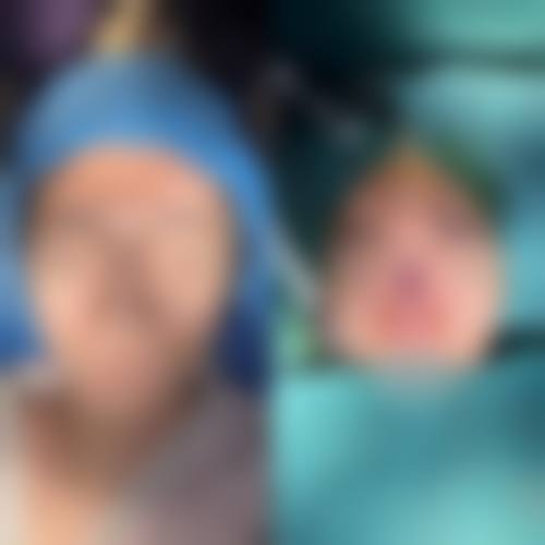 汕头悦美整形医疗美容口碑好不好