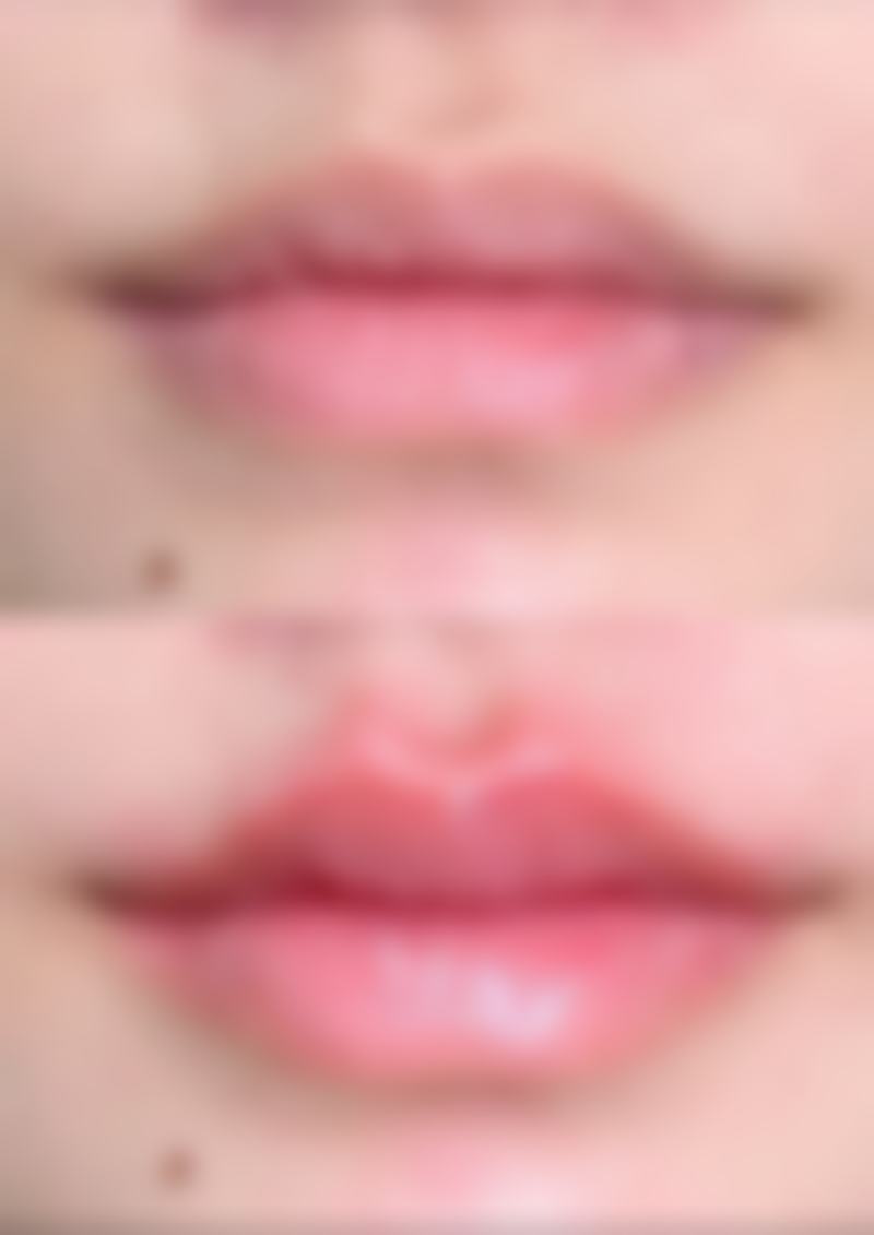 南昌美人春医院整形怎么样价格表