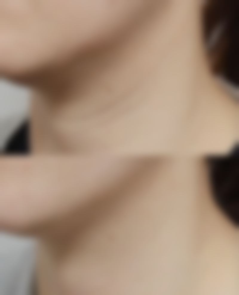 疤痕修复膏有副作用吗：避免副作用的黄金法则