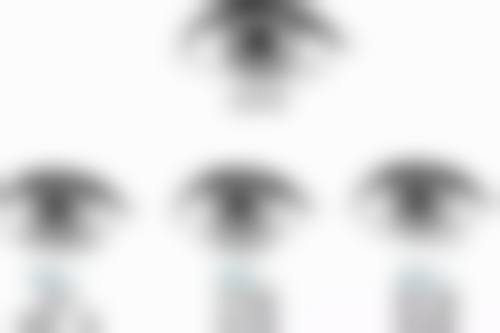 做双眼皮多久可以健身——术后一个月运动情况