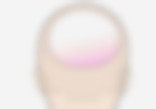 结语:理性看待“一辈子”的确保