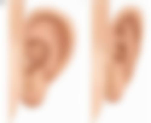 假体隆胸后取出疼吗？北京三甲医生揭秘术后真实感受+恢复攻略