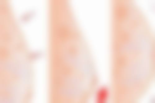 玉林微美医疗美容门诊部特色项目怎么样