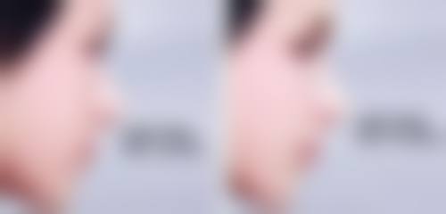 东莞致上口腔怎么样?抖音团购活动有哪些,价格表