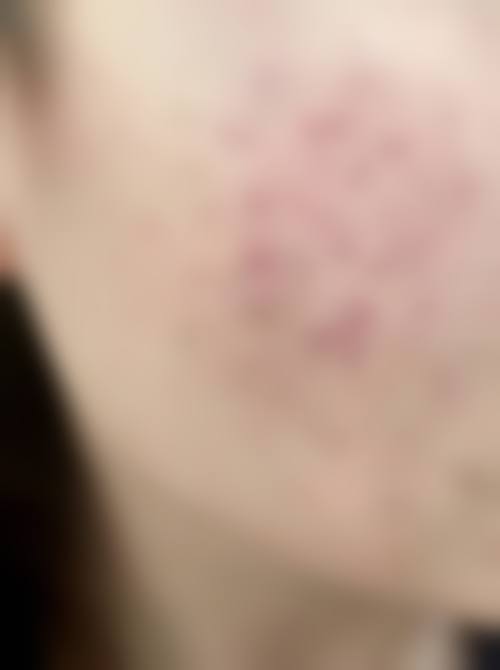 玉林微美医疗美容门诊部更擅长什么