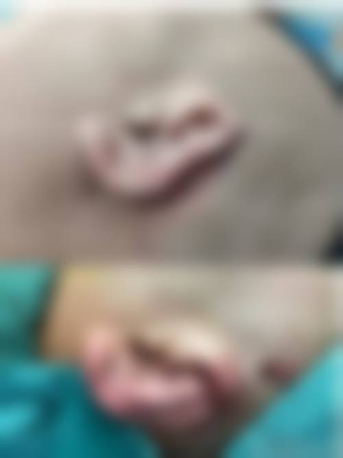 杨仁宝医生简介做手术价格