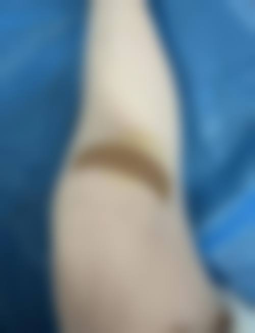 南昌珺美医疗美容诊所更擅长什么手术