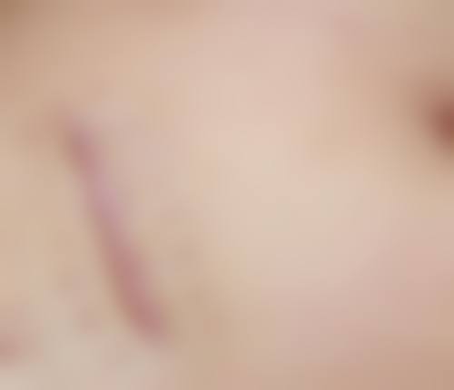 广州德医皮肤美容诊所价格表