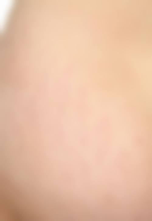 珠海艺星医疗美容门诊部怎么样，有顾客实例吗