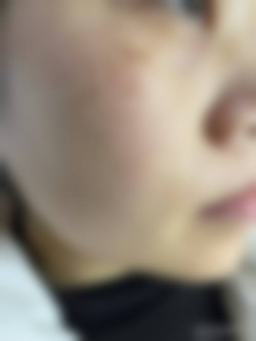 青岛乐菲诗美容整形诊所评价