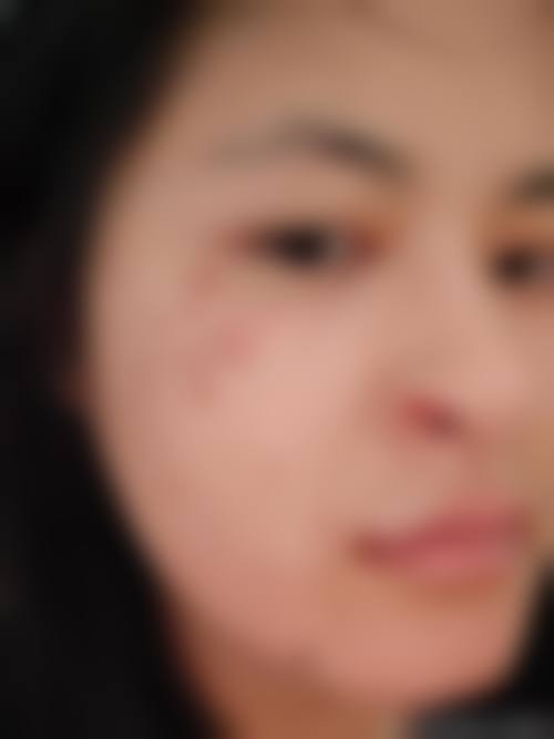 承德熙娅整形医院怎么样之口碑好不好