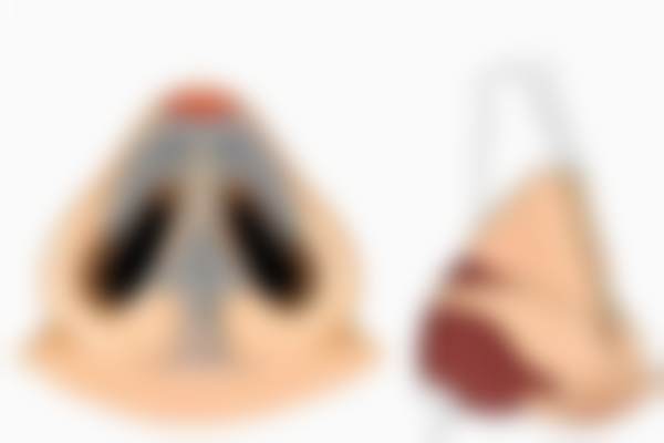 20000元左右唇部修复项目简介