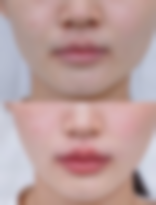 东莞致上口腔怎么样?正规吗?