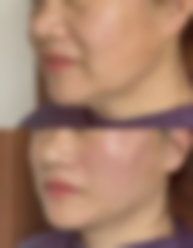 武汉韩辰医疗美容医院可靠吗