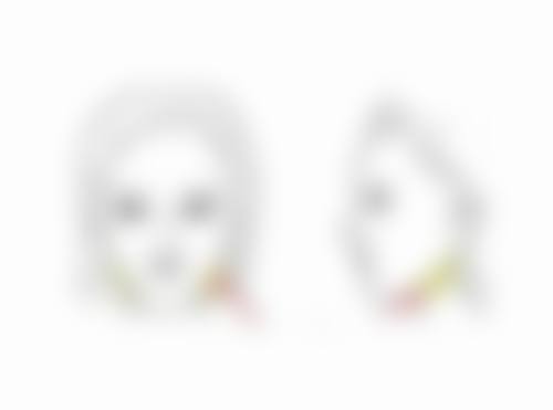 种植发际线长起来的成效：自然度、密度与美学呈现