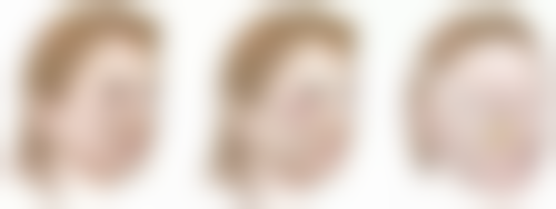 张新华医生简介之做手术价格