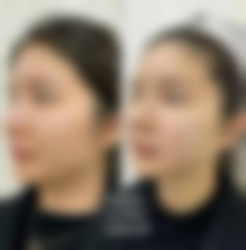 营口奉伊美医疗美容诊所评价