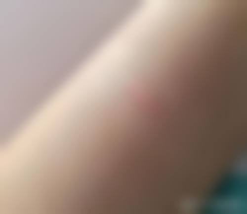 美思科整形外科怎么样，抖音团购活动和价格表