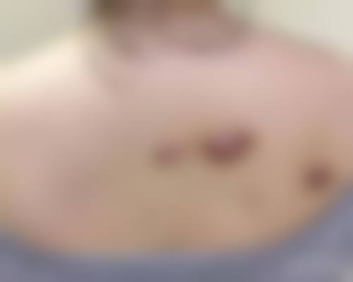 邯郸矿山局烧伤整形医院项目特色