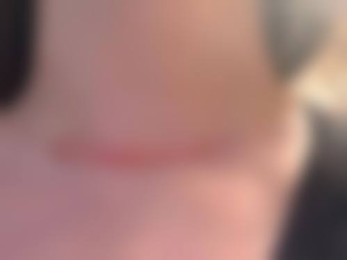 邯郸矿山局烧伤整形医院怎么样，口碑评价如何？