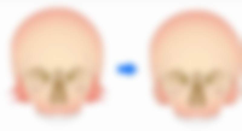 韩国VS整形医院怎么样地址及乘车路线