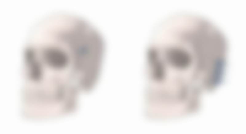 韩国VS整形医院怎么样价格表