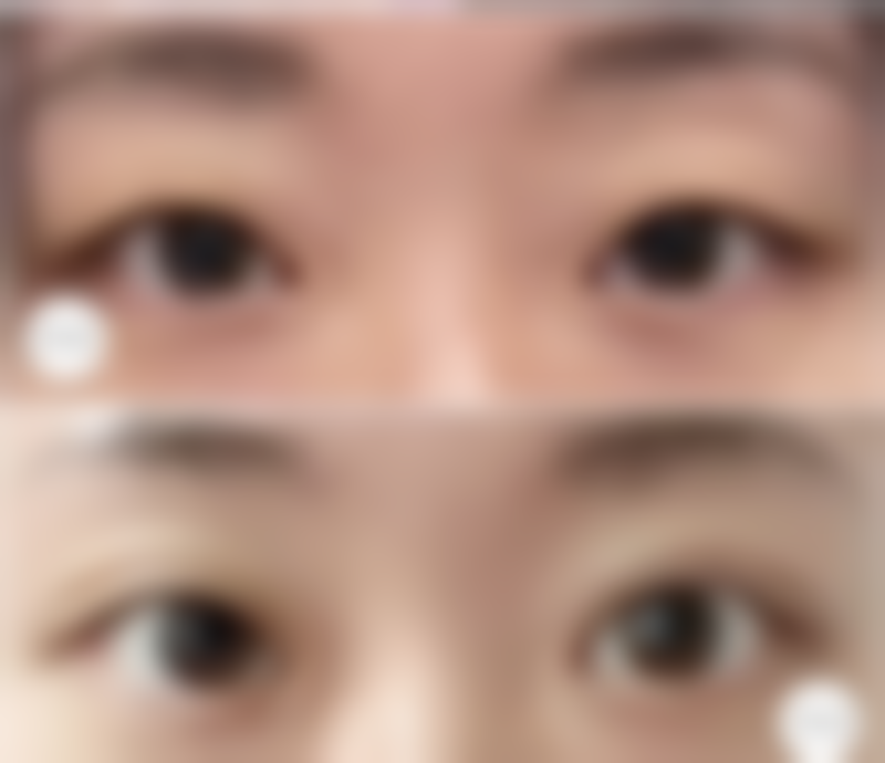 重庆花冠美容诊所更擅长什么手术