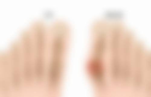 刘学源医生项目优势解读