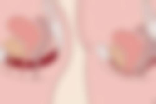 做眼袋手术什么年龄合适——女性魅力提升期（18岁以上，39岁左右）