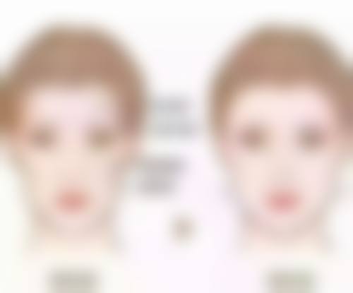 抽脂后腿部多久能不疼：告别“美人鱼上岸”感