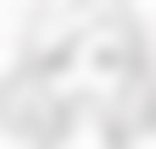 硅胶假体隆胸必须牢记的注意事项