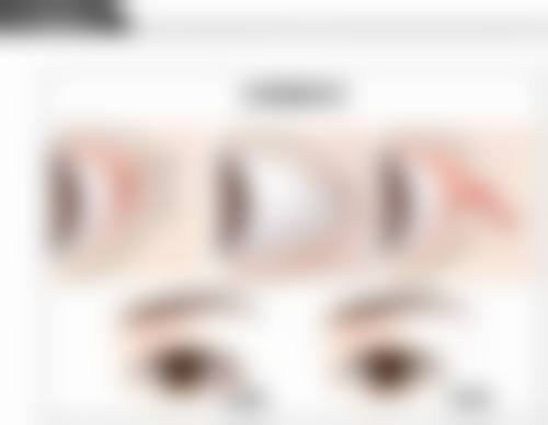 薄建华医生项目优势