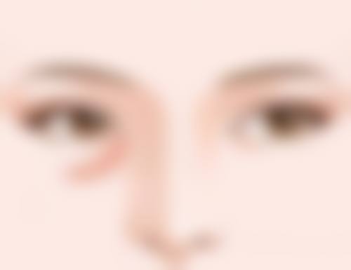 抽脂后除了疼痛，这些修复期现象也正常