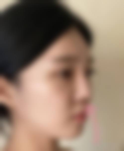 国内医美行业乱象与替代选择