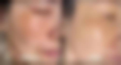 西安出彩医疗美容门诊部顾客实例