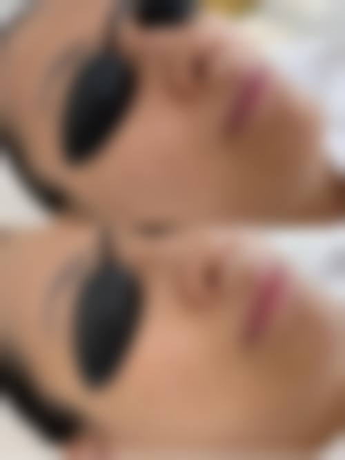 洛阳协和医疗美容医院口碑好不好，附真实患者口碑评价