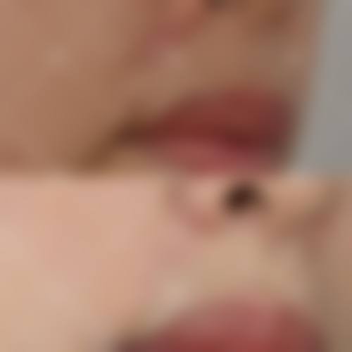 赴韩整形的注意事项与风险规避