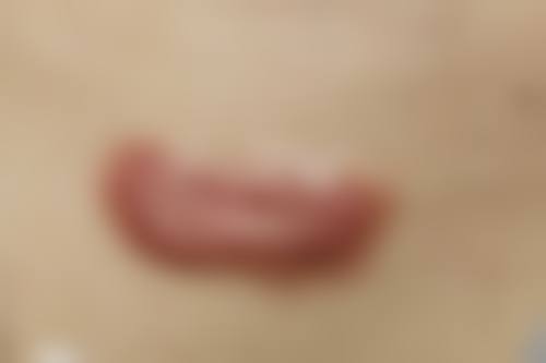 广西壮族自治区皮肤病医院基本信息