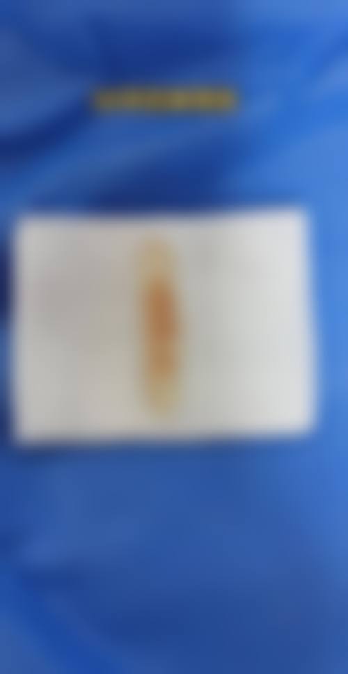 泉州星念医疗美容的口碑好不好