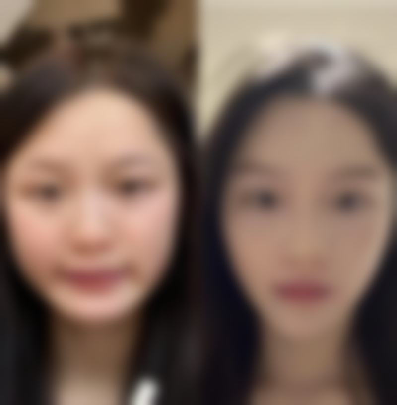 薄建华医生怎么挂号