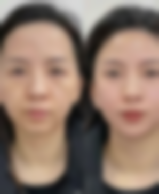 薄建华医生顾客实例图片