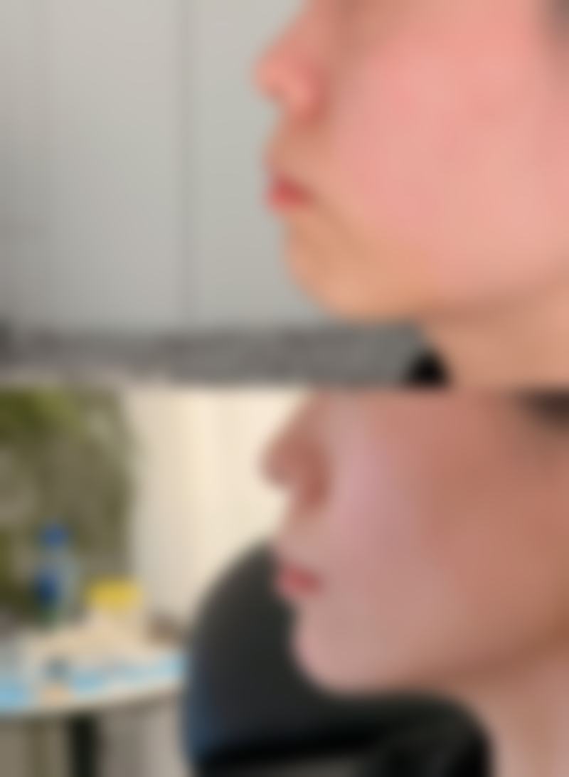 杨小刚医生简介做手术价格