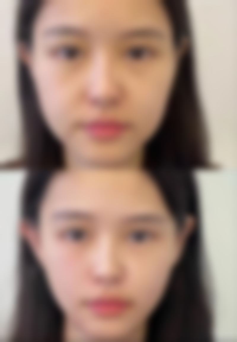 刘学源医生顾客实例展示