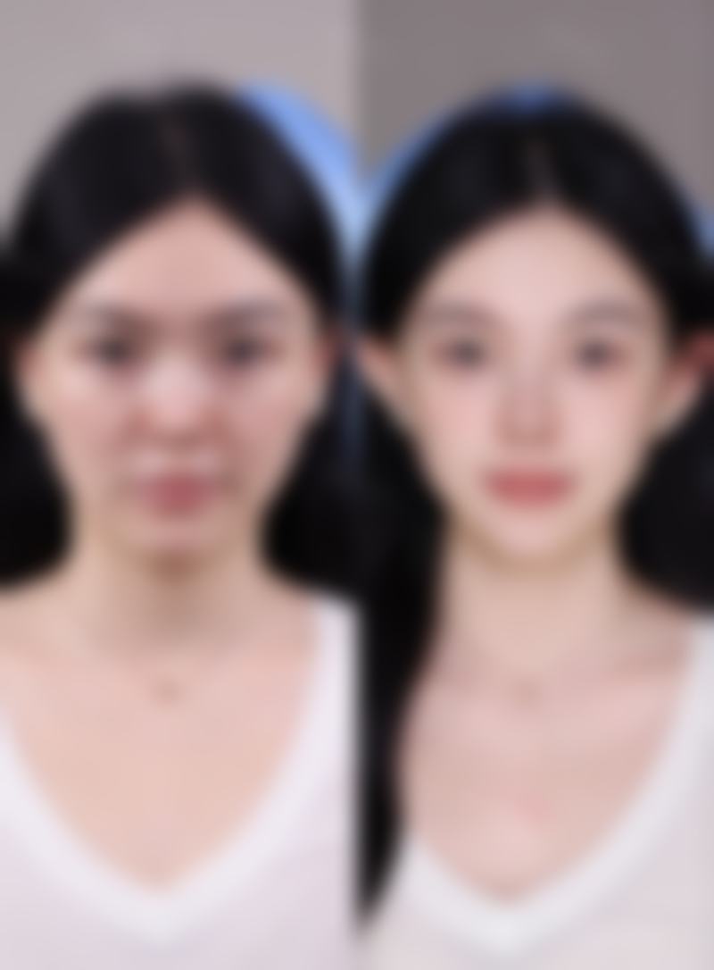 刘学源医生口碑评价