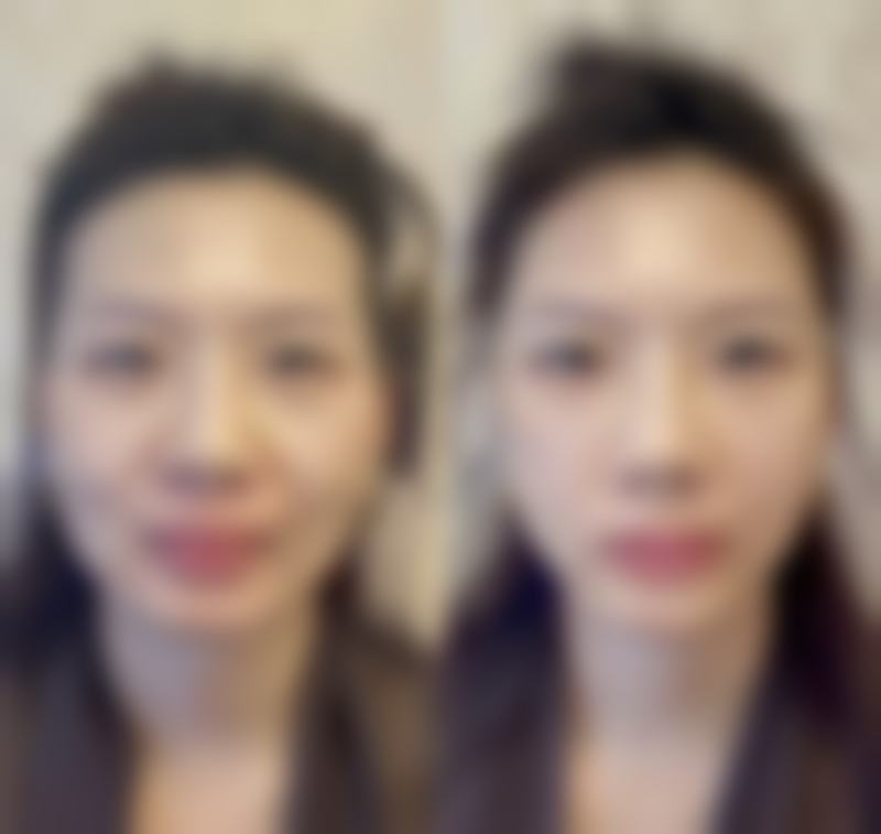 洛阳协和医疗美容医院价格表