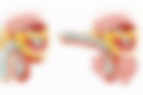 怎么把单眼皮眼睛睡成双眼皮：针对性解决方案攻克难关