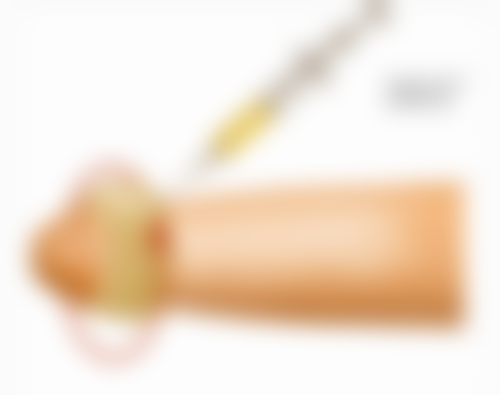 怎么把小眼睛睡成双眼皮：按摩与睡姿结合放大视觉成效