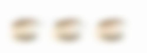 隆鼻一次能保持多久？硅胶10年VS玻尿酸6个月，选对材料是关键！